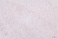 Anti-HMGB1 Antibody Picoband™ (monoclonal, 5H3)